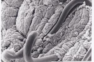 Roundworm
